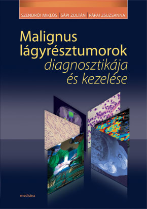 Malignus lágyrésztumorok diagnosztikája és kezelése 1743