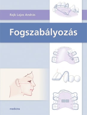 Fogszabályozás 208