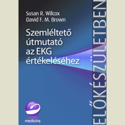Szemléltető útmutató az EKG értékeléséhez