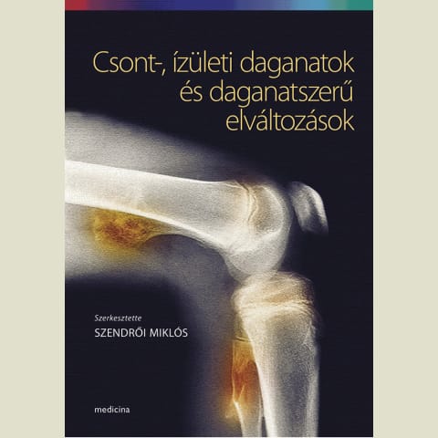 Csont-, ízületi daganatok és daganatszerű elváltozások