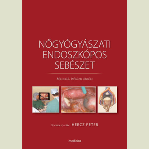 Nőgyógyászati endoszkópos sebészet