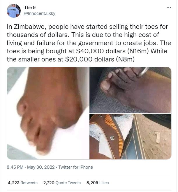 The 9 innocentzikky in zimbabwe, people have started selling their toes for thou