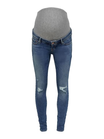 ONLY Skinny Jeans in Medium Blue Denim