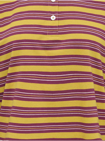 ONLY Polo in Fig 1