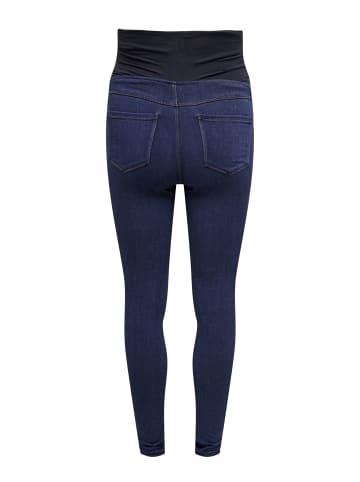 ONLY Skinny Jeans in Dark Blue Denim