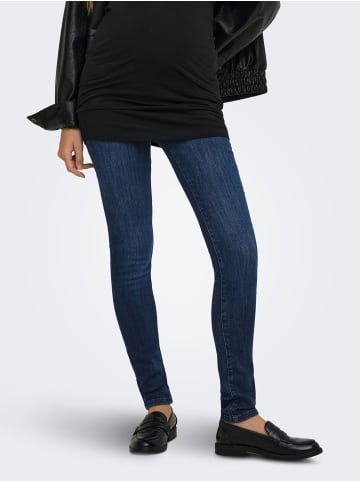 ONLY Skinny Jeans in Dark Blue Denim