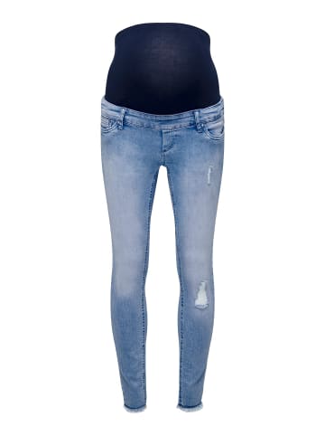 ONLY Skinny Jeans in Light Blue Denim
