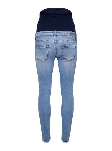 ONLY Skinny Jeans in Light Blue Denim