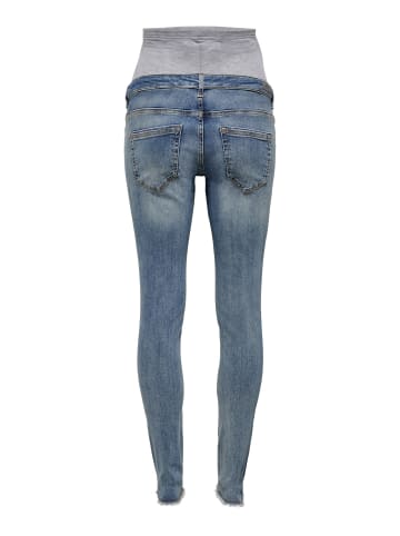 ONLY Skinny Jeans in Medium Blue Denim