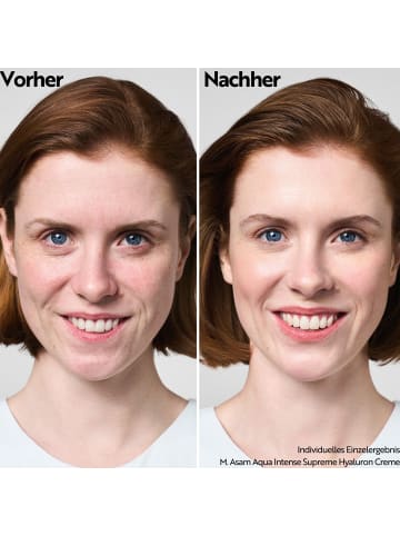 M. Asam AQUA INTENSE Supreme Hyaluron Cream 100 ml