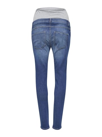 ONLY Skinny Jeans in Medium Blue Denim