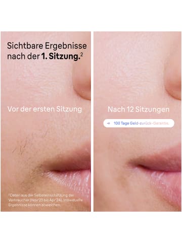 Braun IPL "Skin i-expert Pro - PL7249" in Weiß/Bronze