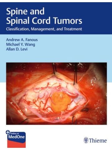 Thieme, Stuttgart Buch - Spine and Spinal Cord Tumors