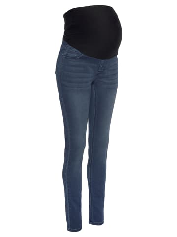 Umstandsjeans in dark-blue-used