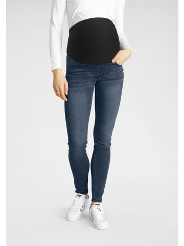 Umstandsjeans in dark-blue-used