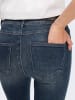 ONLY Skinny Fit Ankle Jeans ONLMILA Denim High Waist Hose in Blau-2