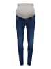 ONLY Skinny Jeans in Dark Blue Denim