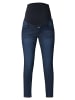 Noppies Skinny Umstandsjeans Avi in Dark Blue