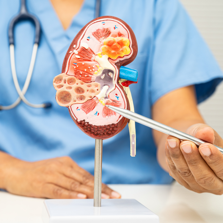 Chirurgie de la lithiase urinaire