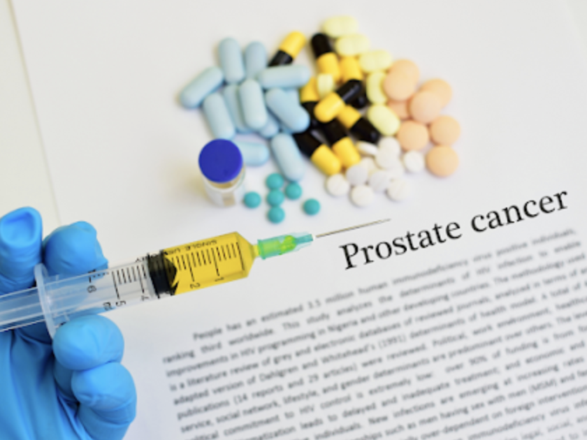 Cancer de la prostate
