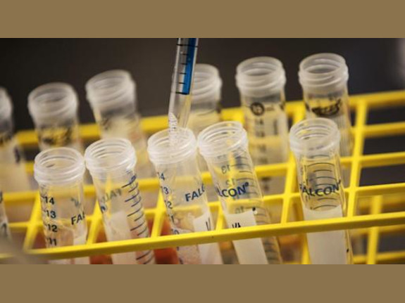 In-Network Full-Service Lab, California, NY, Pa