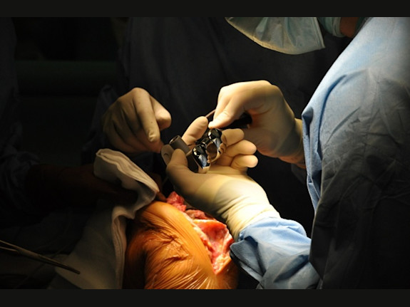 Orthopedic Device Co for Sale in Morris County