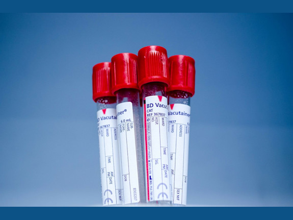 Laboratory with Medicare, 550K gross