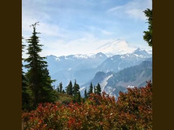 High Visibility Renton, WA Optometry Practice