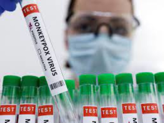 Monkey Pox Testing for Labs