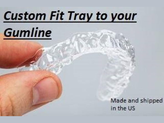 Teeth Whitening Business For Sale