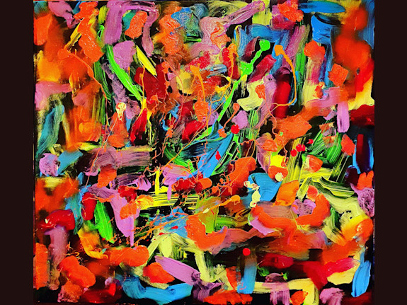 1M$+ Contract and Artistic Assets