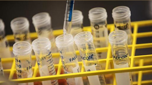 In-Network Full-Service Lab, California, NY, Pa