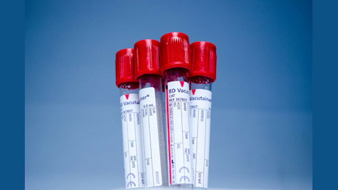 Laboratory with Medicare, 550K gross