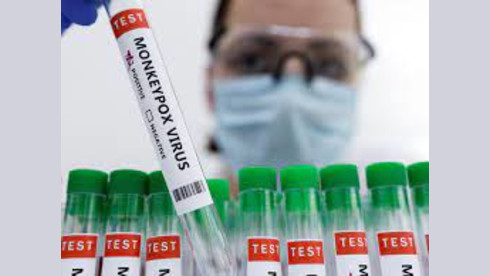 Monkey Pox Testing for Labs