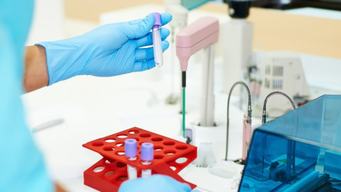 High Complexity, COLA Accredited Molecular AZ Lab