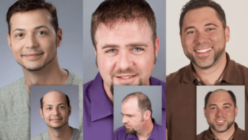 Established, Profitable Hair Restoration Business