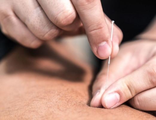 Extremely Profitable Acupuncture Practice