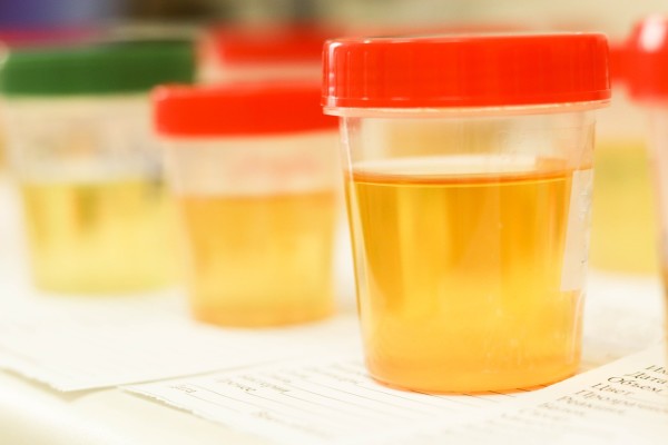 High Compl. Lab, Toxicology, COVID, Genetic, Blood