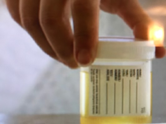 Toxicology Laboratory in OC, CLIA, COLA Equipment