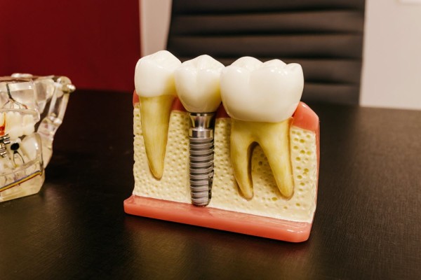 Dental Lab - Home-based or Rent Office