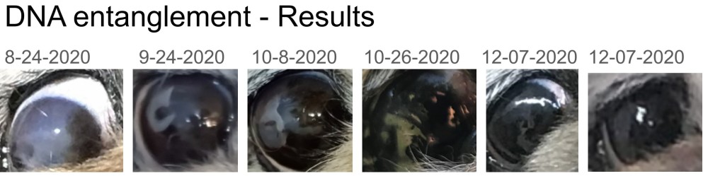 No Cut or Drugs Cataract Elimination via DNArewind