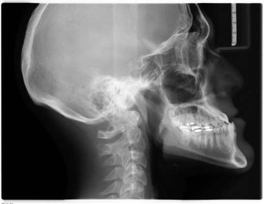 Impressive Growth Mobile Radiology X-Ray Business