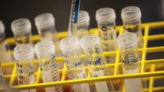 In-Network Full-Service Lab, California, NY, Pa