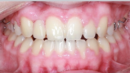 Dental Lab. Est 29 Yrs. for Sale