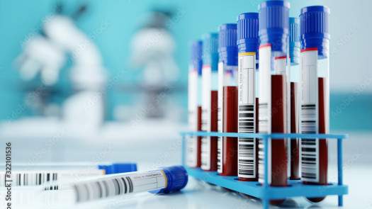 30 yrs. lab, BC, BS, UHC, Health Net, Medi-Medi