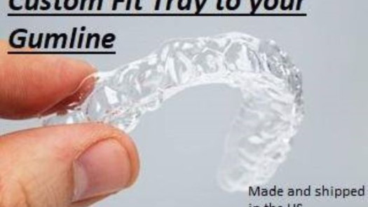 Teeth Whitening Business For Sale