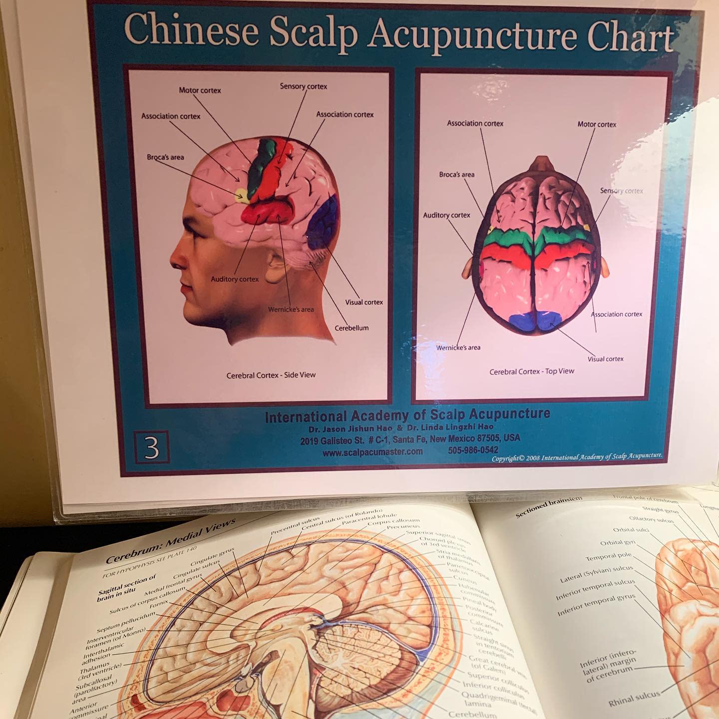NeuroAcupuncture