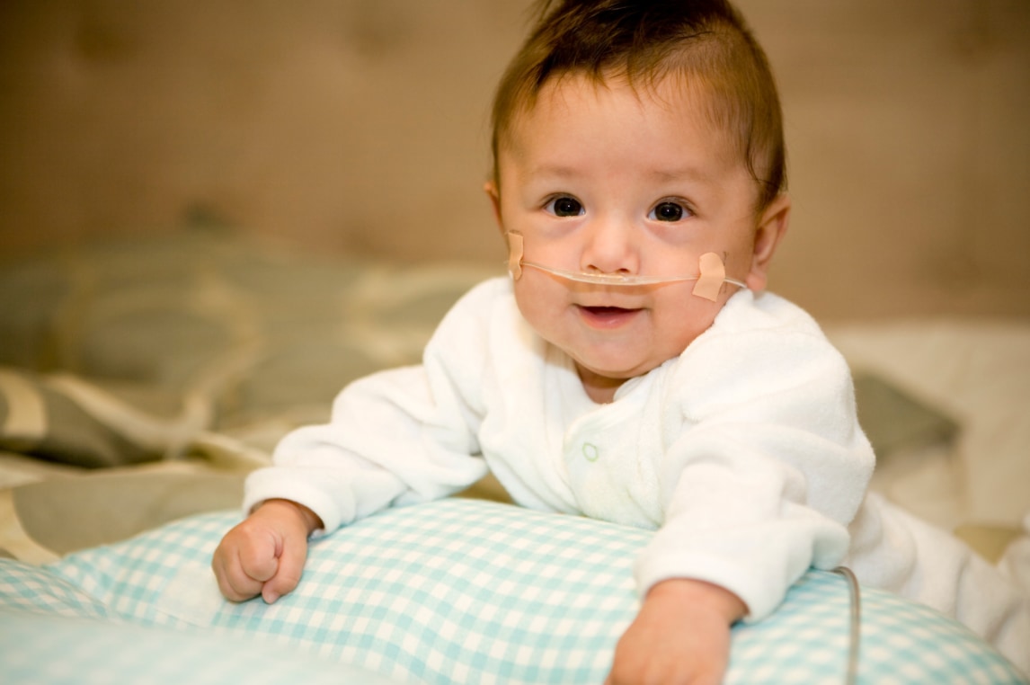 infant using oxygen smiling at viewer