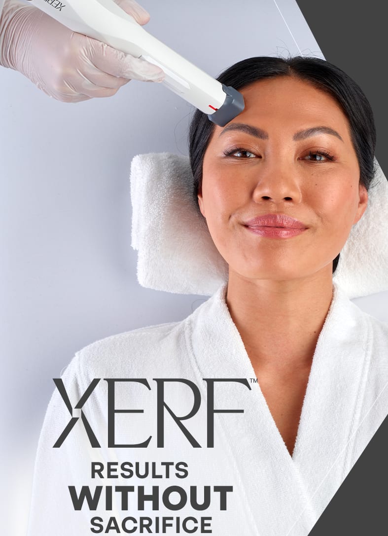 XERF skin tightening treatment on face for non-surgical lift