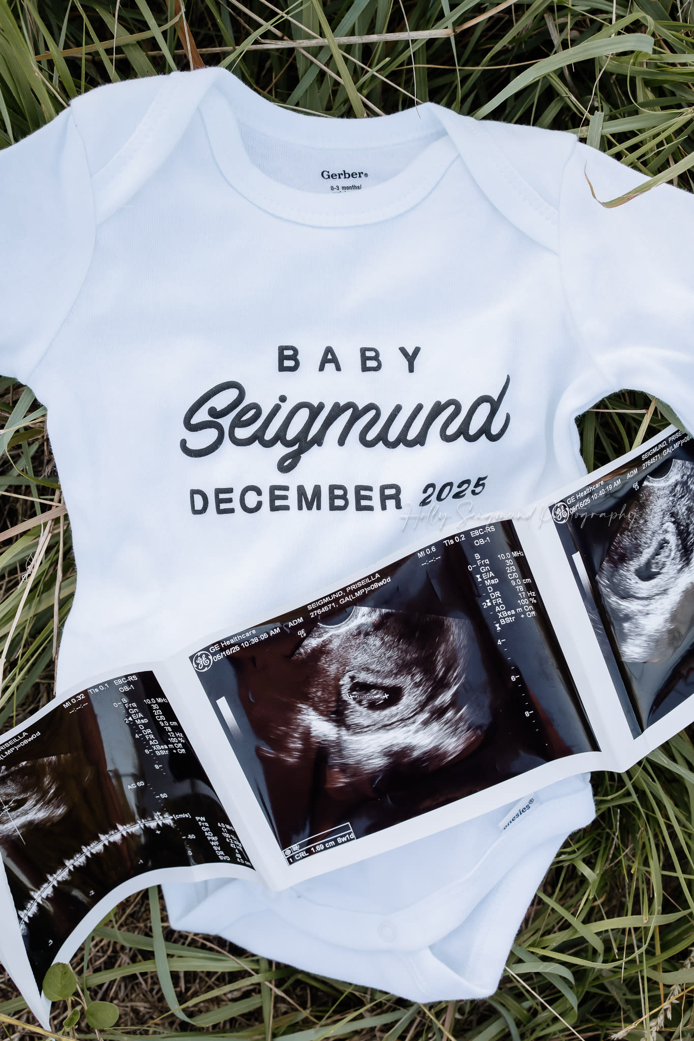 Baby Pregnancy Announcement Photography Session Sonogram Photo
